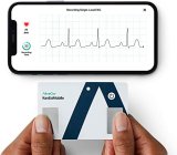 KardiaMobile Card Personal EKG Monitor – Fits in Your Wallet – Detects AFib and Irregular Arrhythmias – Instant Results in 30 Seconds – Easy to Use – Works with Most Smartphones – FSA/HSA Eligible
